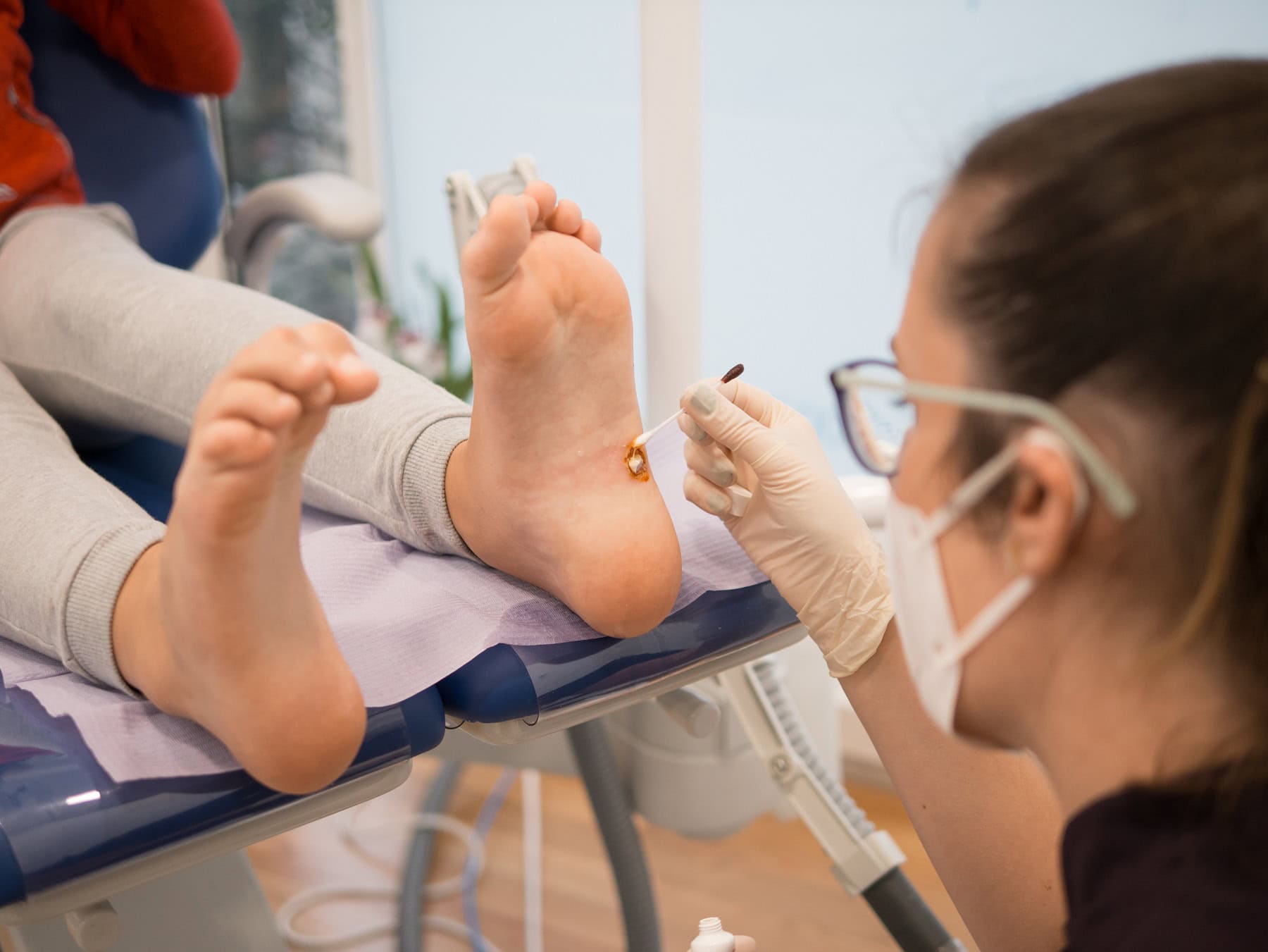 plantar warts kids feet