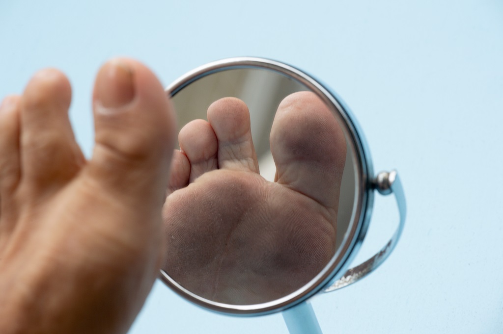 Diabetic Foot Care Steps