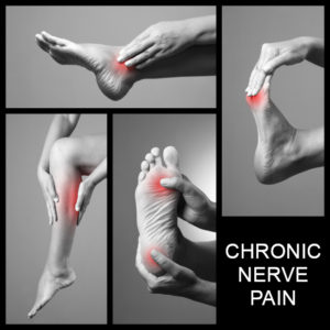 chronic-nerve-pain-apc