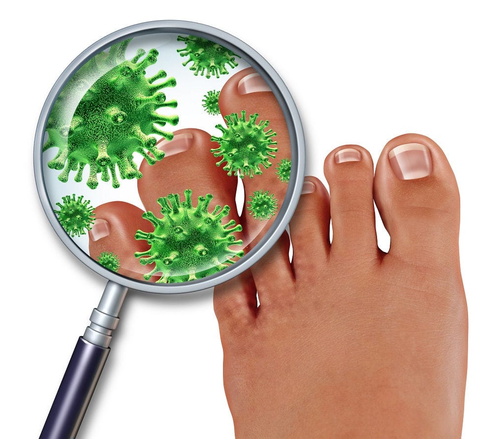 foot fungus