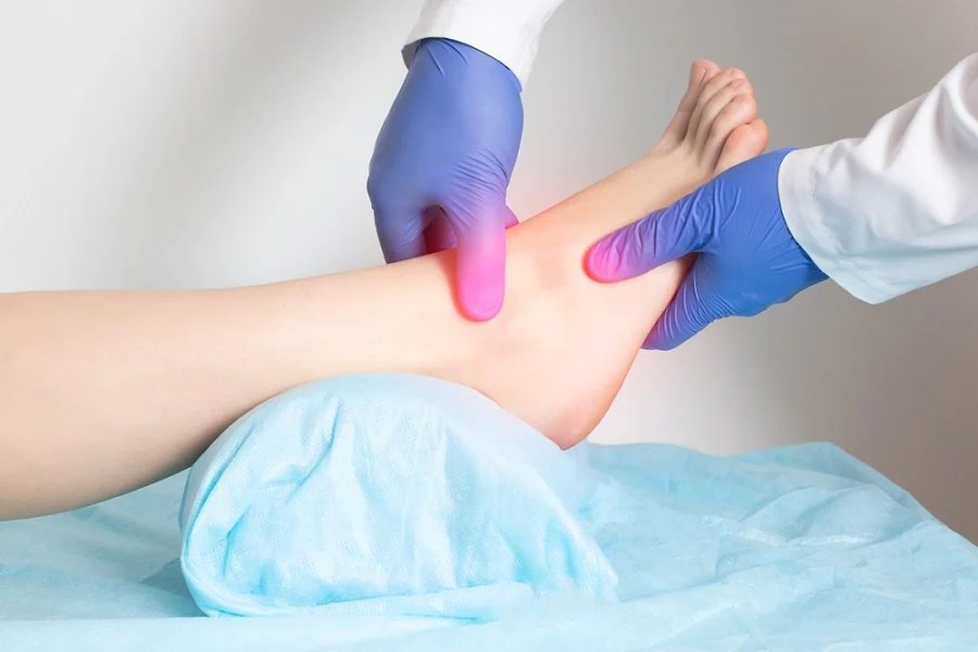 ankle swelling flatfoot