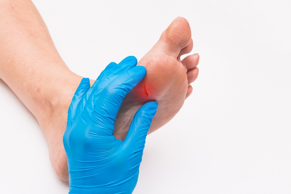 diabetic foot amputations