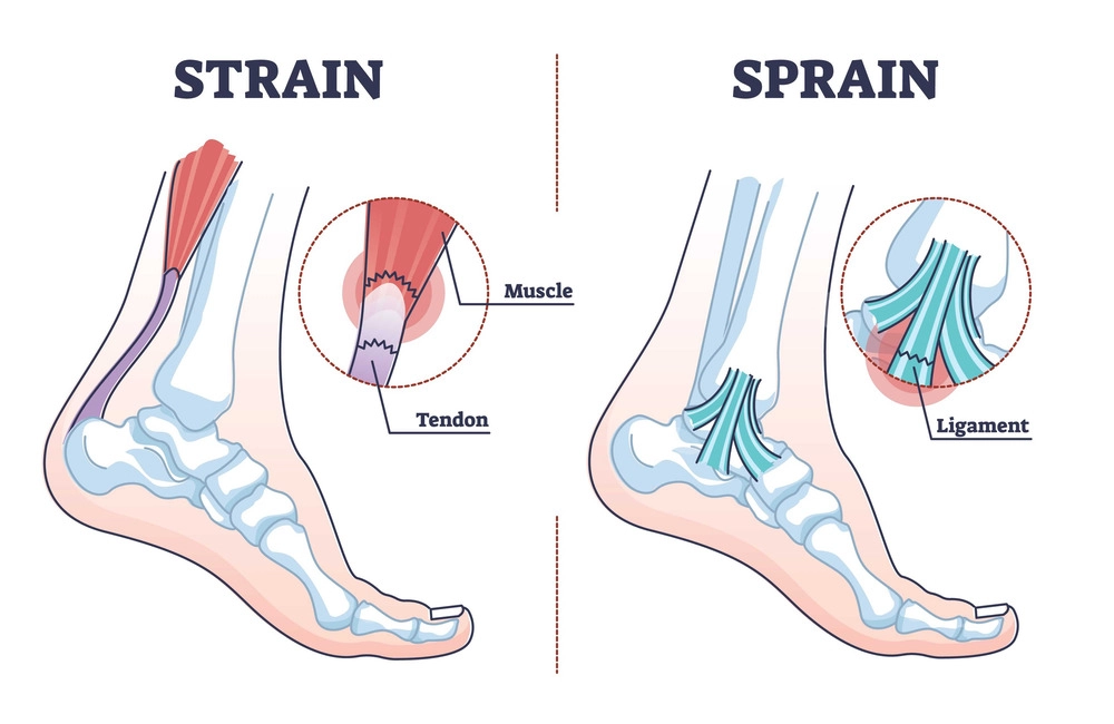 foot ligament injury