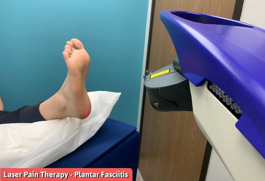 Laser Pain Therapy Plantar Fasciitis