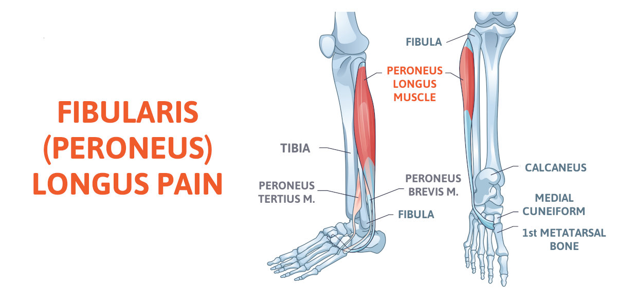 fibularis longus pain
