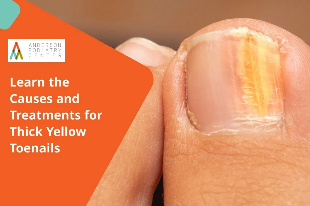 causes and treatments for thick yellow toenails